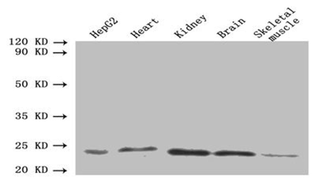 Western blot. All lanes: ORM2 antibody at 1.6µg/ml. Lane 1: HepG2 whole cell lysate. Lane 2: Mouse heart tissue. Lane 3: Mouse kidney tissue. Lane 4: Mouse brain tissue. Lane 5: Mouse skeletal muscle tissue. Secondary. Goat polyclonal to rabbit IgG at 1/10000 dilution. Predicted band size: 24 kDa. Observed band size: 24 kDa