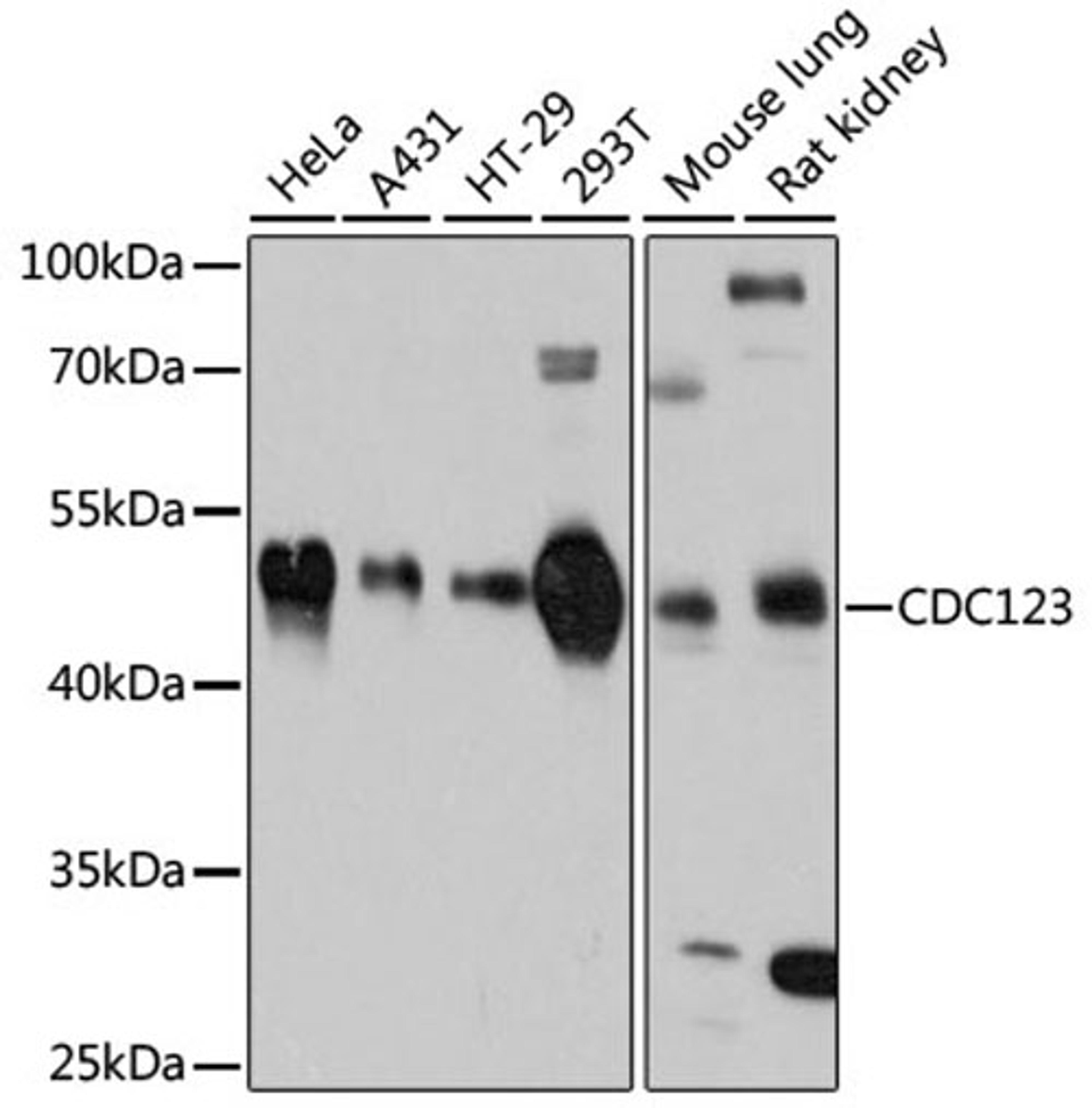 Western blot - CDC123 antibody (A11695)