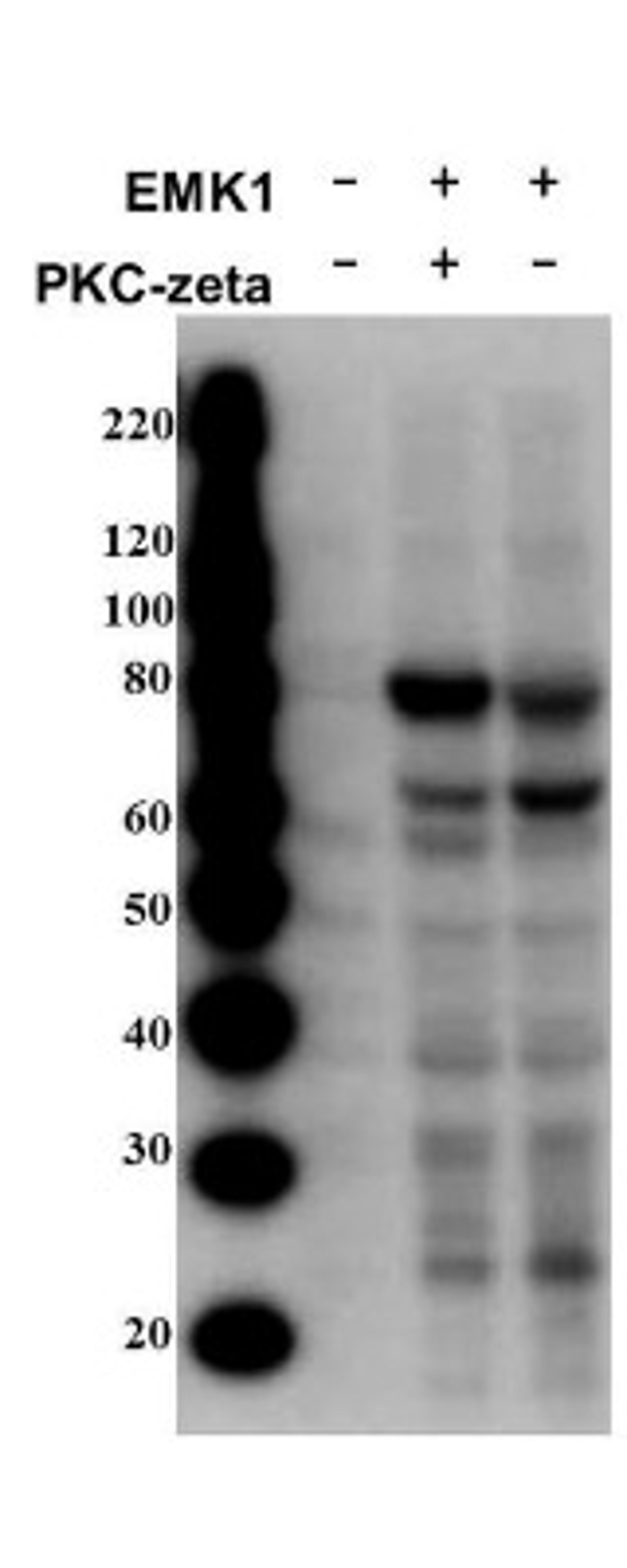 Western Blot: MARK2 [p Thr595] Antibody [NBP1-78028] - Lane 1: 293T cells untransfected. Lane 2: 293T cells transfected with MARK2 and PKC-zeta. Lane 3: 293T cells transfected with MARK2. Load: 35 ug per lane. Used at a dilution of 1:1000 for overnight at 4C.