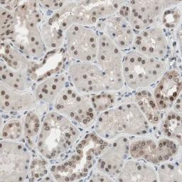 Immunohistochemistry-Paraffin: LONP2 Antibody [NBP1-81294] - Staining of human kidney shows strong nuclear and weak cytoplasmic positivity in cells in tubules.