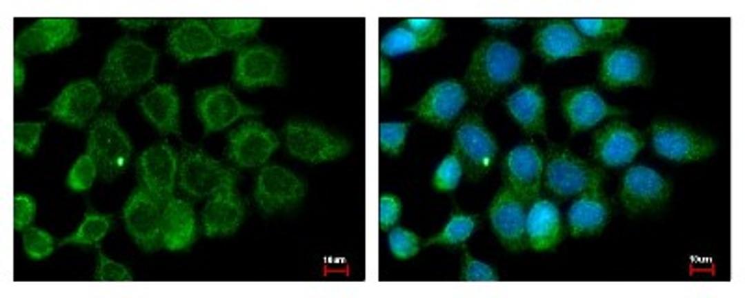 Immunocytochemistry/Immunofluorescence: ALS2CR12 Antibody [NBP2-15366] - Sample: A431 cells were fixed in ice-cold Methanol for 5 min. Green: ALS2CR12 protein stained by ALS2CR12 antibody diluted at 1:500. Blue: Hoechst 33343 staining.