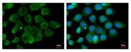 Immunocytochemistry/Immunofluorescence: ALS2CR12 Antibody [NBP2-15366] - Sample: A431 cells were fixed in ice-cold Methanol for 5 min. Green: ALS2CR12 protein stained by ALS2CR12 antibody diluted at 1:500. Blue: Hoechst 33343 staining.