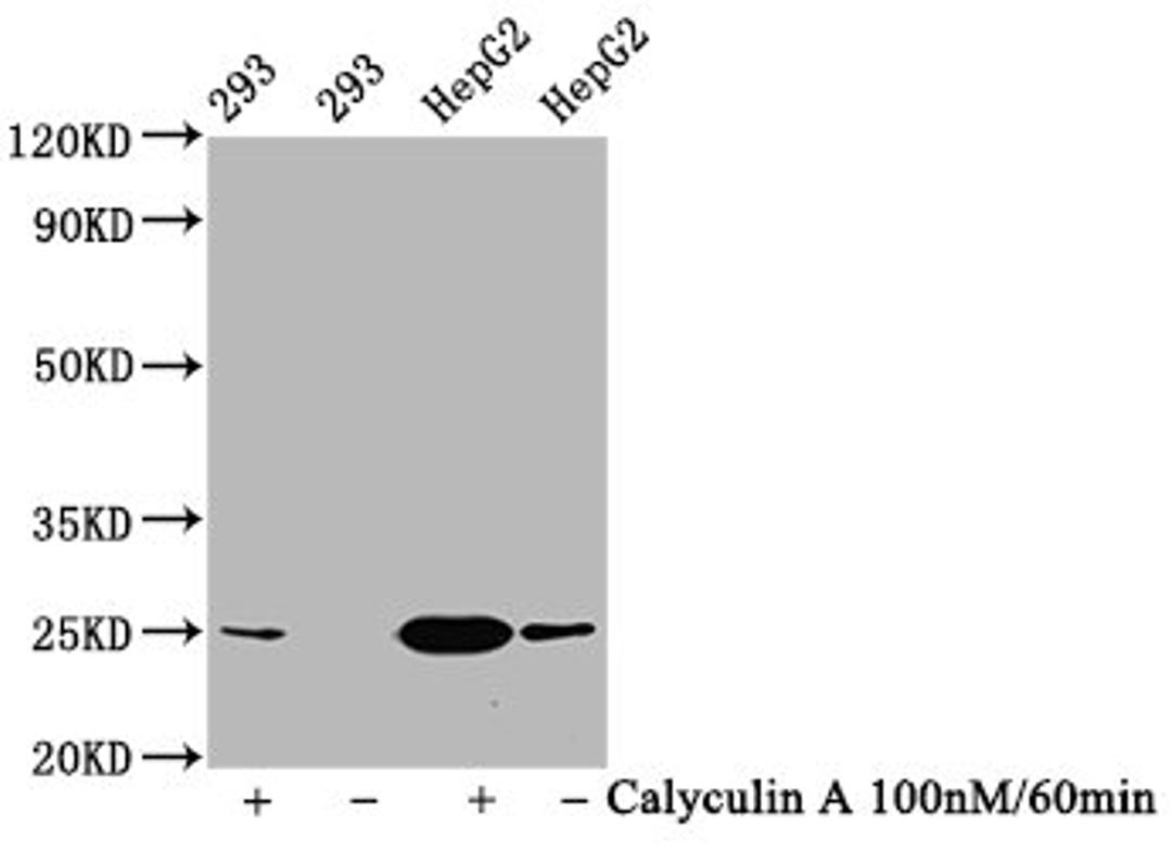 Western Blot. Positive WB detected in 293 whole cell lysate,HepG2 whole cell lysate(treated with Calyculin A or not). All lanes Phospho-EIF4E antibody at 1.2μg/ml. Secondary. Goat polyclonal to rabbit IgG at 1/50000 dilution. Predicted band size: 25 KDa. Observed band size: 25 KDa. 