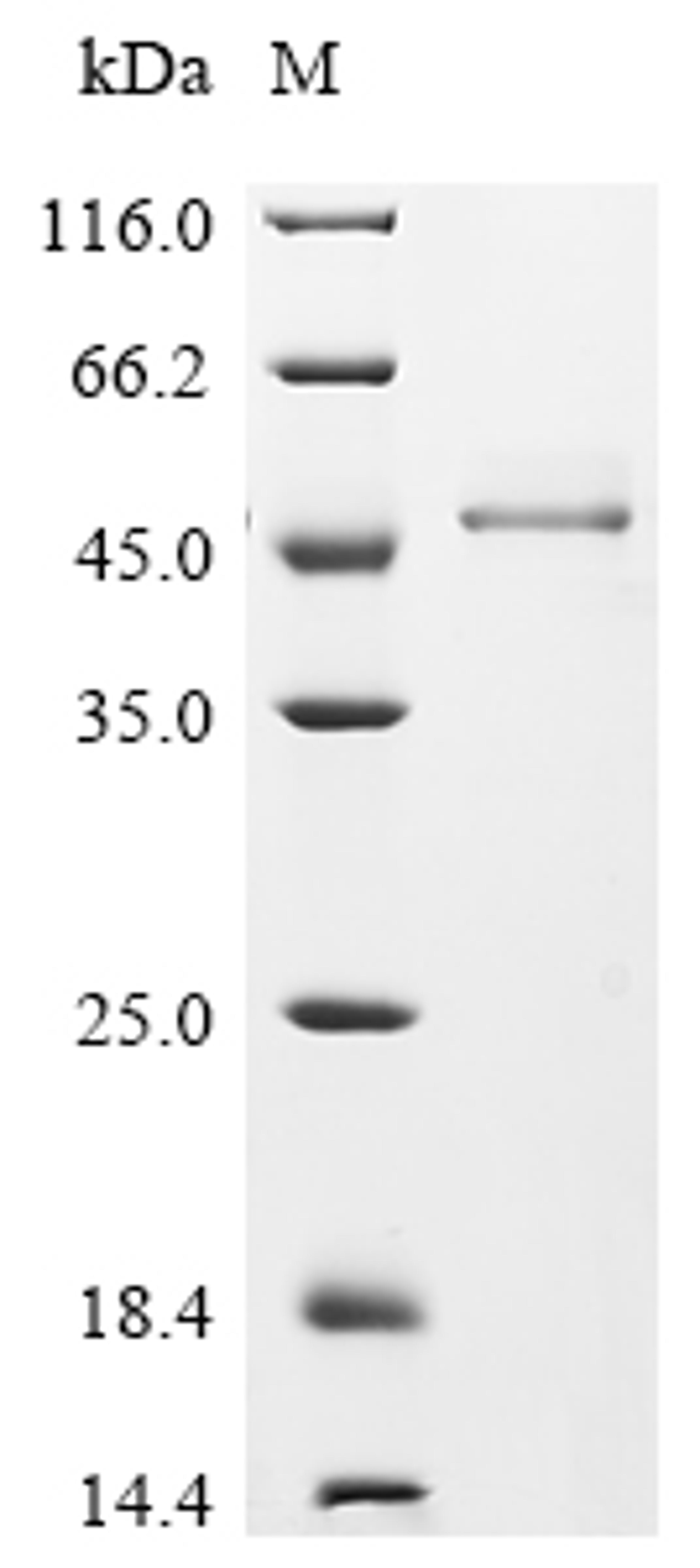 (Tris-Glycine gel) Discontinuous SDS-PAGE (reduced) with 5% enrichment gel and 15% separation gel.