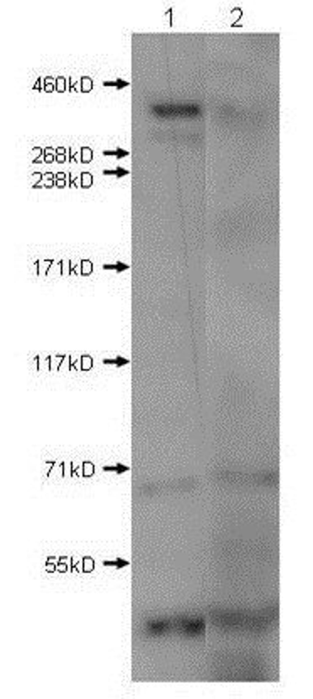 Western blot analysis of Lane 1: mouse brain extract. Lane 2: mouse brain extract with blocking peptide. Load: 10 ug per lane using Huntington antibody