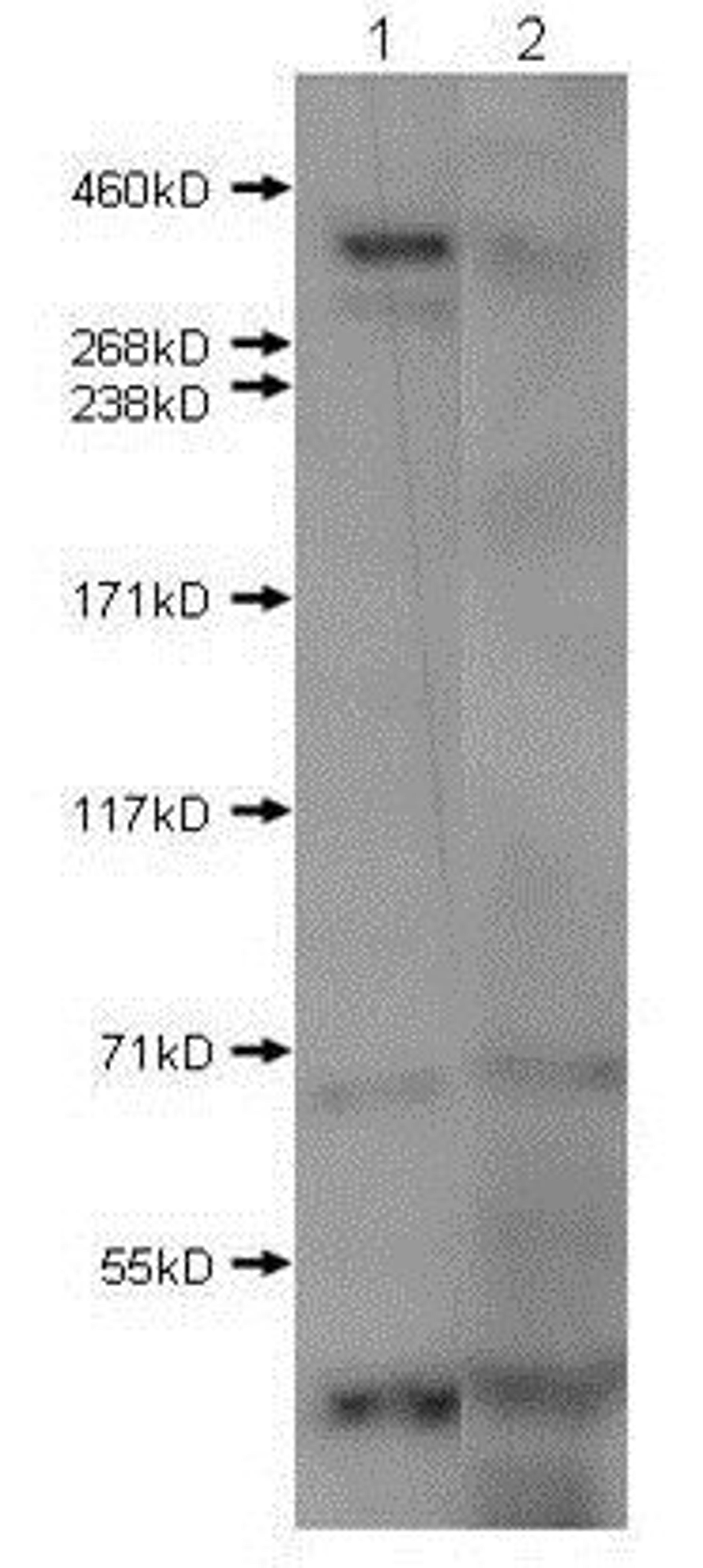 Western blot analysis of Lane 1: mouse brain extract. Lane 2: mouse brain extract with blocking peptide. Load: 10 ug per lane using Huntington antibody