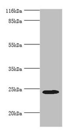 Western blot. All lanes: MIS12 antibody at 2ug/ml + Hela whole cell lysate. Secondary. Goat polyclonal to rabbit IgG at 1/10000 dilution. Predicted band size: 25 kDa. Observed band size: 25 kDa. 