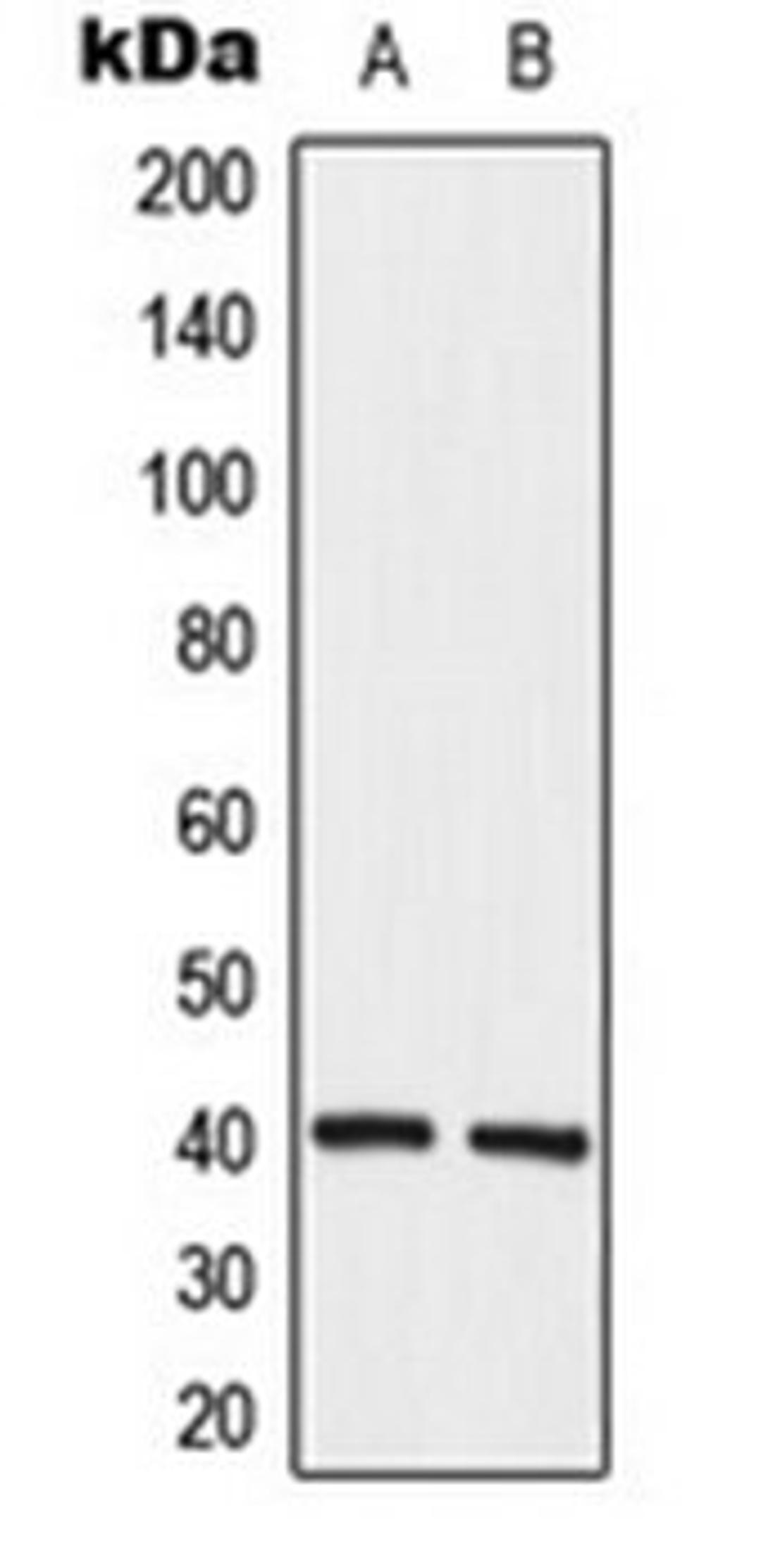 Western blot analysis of K562 (Lane 1), HeLa (Lane 2) whole cell lysates using HuB antibody