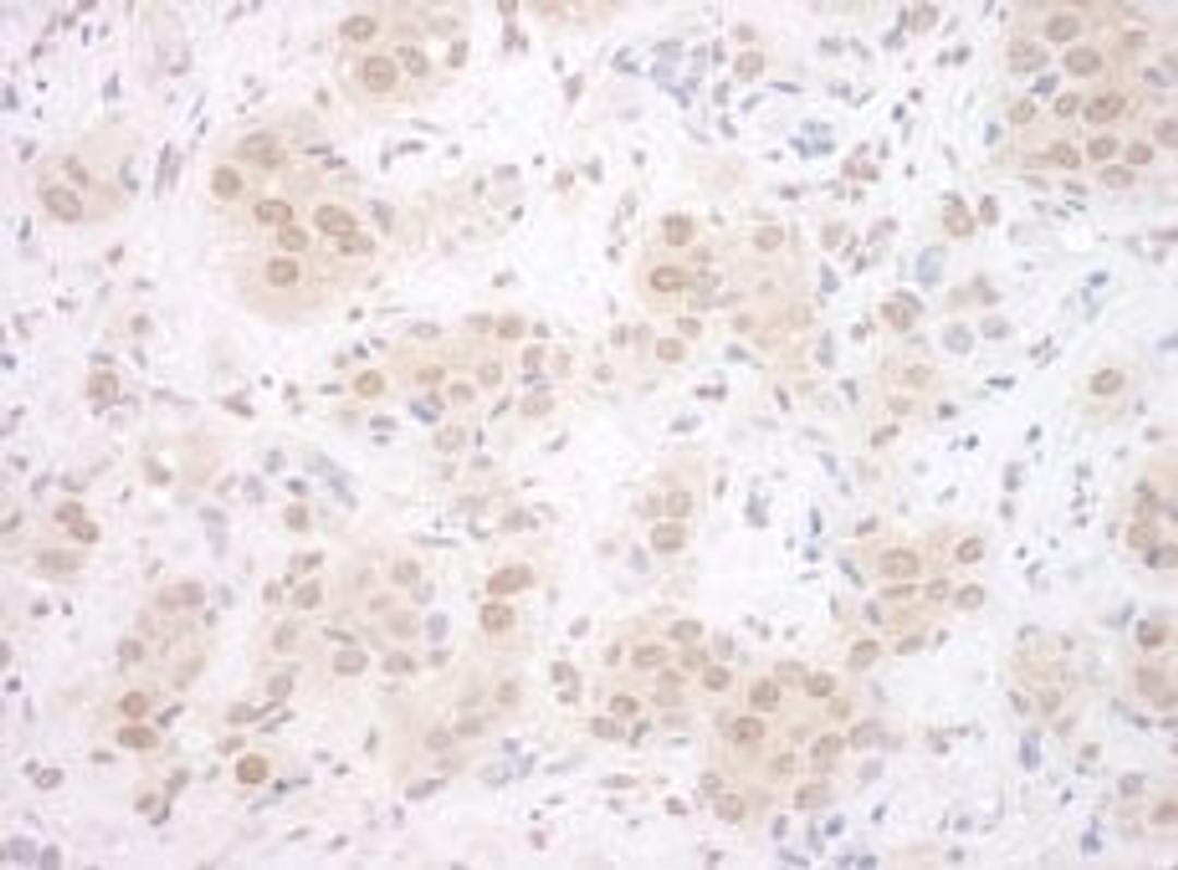 Detection of human EYA3 by immunohistochemistry.