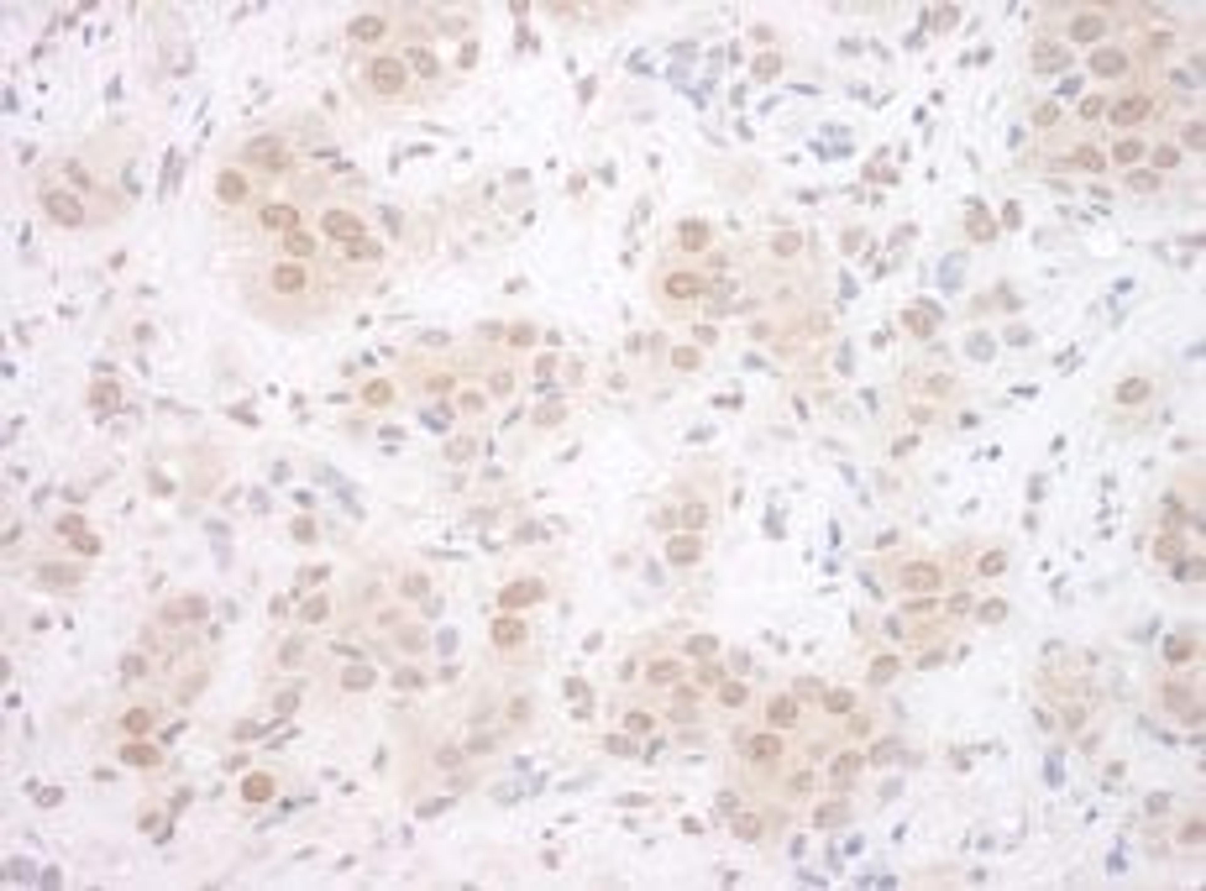 Detection of human EYA3 by immunohistochemistry.