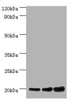 Western blot. All lanes: NAA20 antibody at 10µg/ml. Lane 1: Hela whole cell lysate. Lane 2: Rat brain tissue. Lane 3: 293T whole cell lysate. Secondary. Goat polyclonal to rabbit IgG at 1/10000 dilution. Predicted band size: 21, 13 kDa. Observed band size: 21 kDa