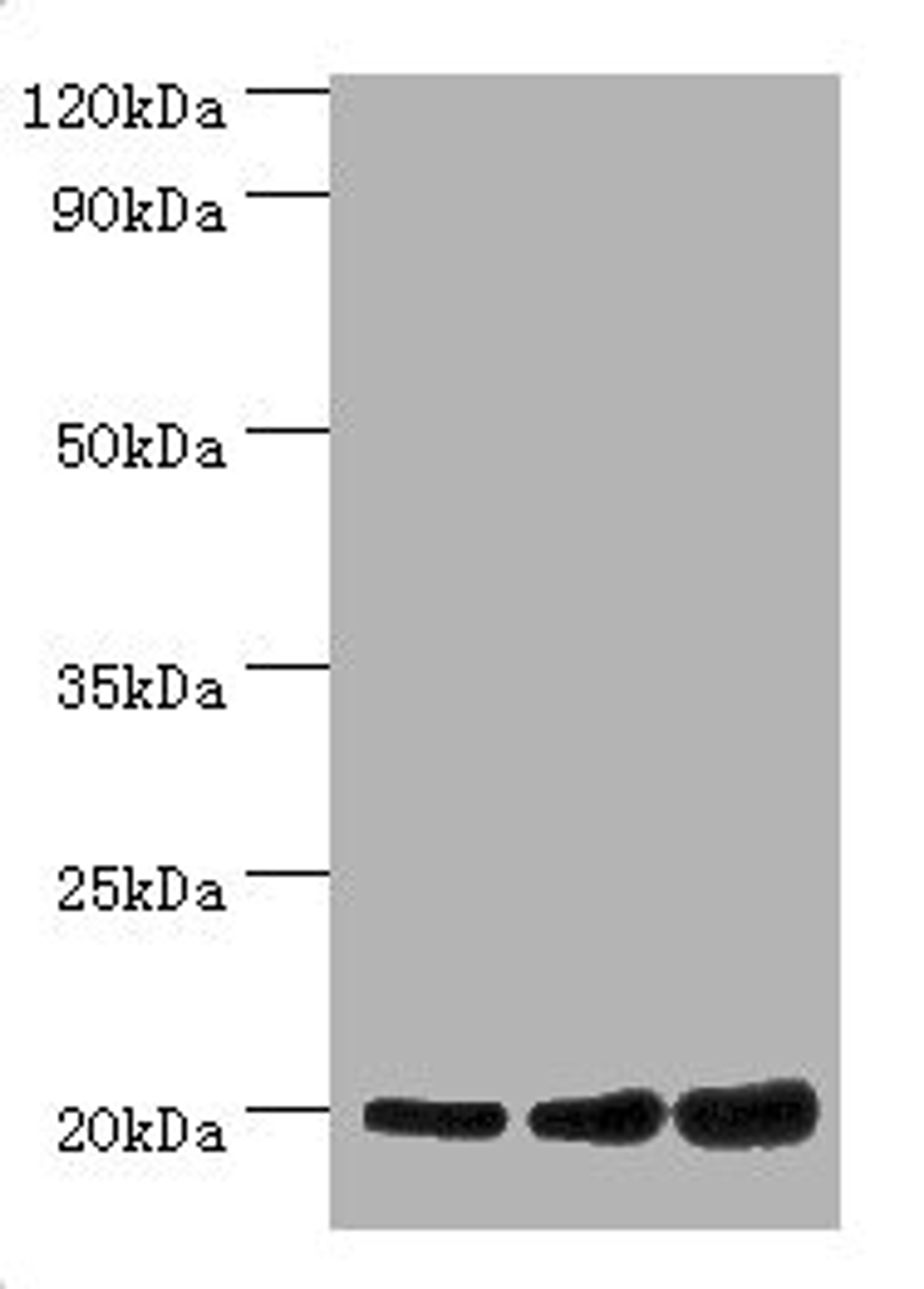 Western blot. All lanes: NAA20 antibody at 10µg/ml. Lane 1: Hela whole cell lysate. Lane 2: Rat brain tissue. Lane 3: 293T whole cell lysate. Secondary. Goat polyclonal to rabbit IgG at 1/10000 dilution. Predicted band size: 21, 13 kDa. Observed band size: 21 kDa