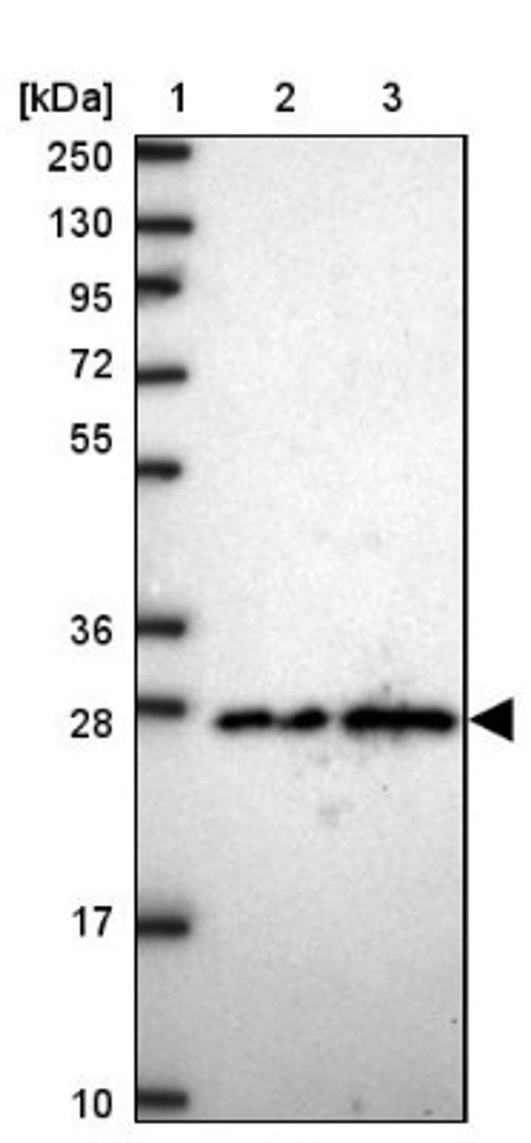 Immunohistochemistry: Lysozyme Antibody [NBP2-33518] - Lane 1: Marker [kDa] 250, 130, 95, 72, 55, 36, 28, 17, 10<br/>Lane 2: Human cell line RT-4<br/>Lane 3: Human cell line U-251MG sp