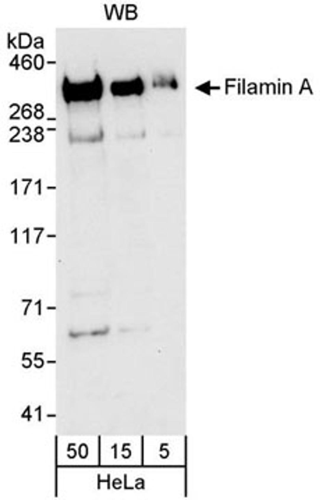 Detection of human Filamin A by western blot.