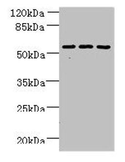 Western blot. All lanes: ZNF19 antibody at 4µg/ml. Lane 1: Mouse liver tissue. Lane 2: MDA-MB-231 whole cell lysate. Lane 3: HepG2 whole cell lysate. Secondary. Goat polyclonal to rabbit IgG at 1/10000 dilution. Predicted band size: 53, 52 kDa. Observed band size: 53 kDa