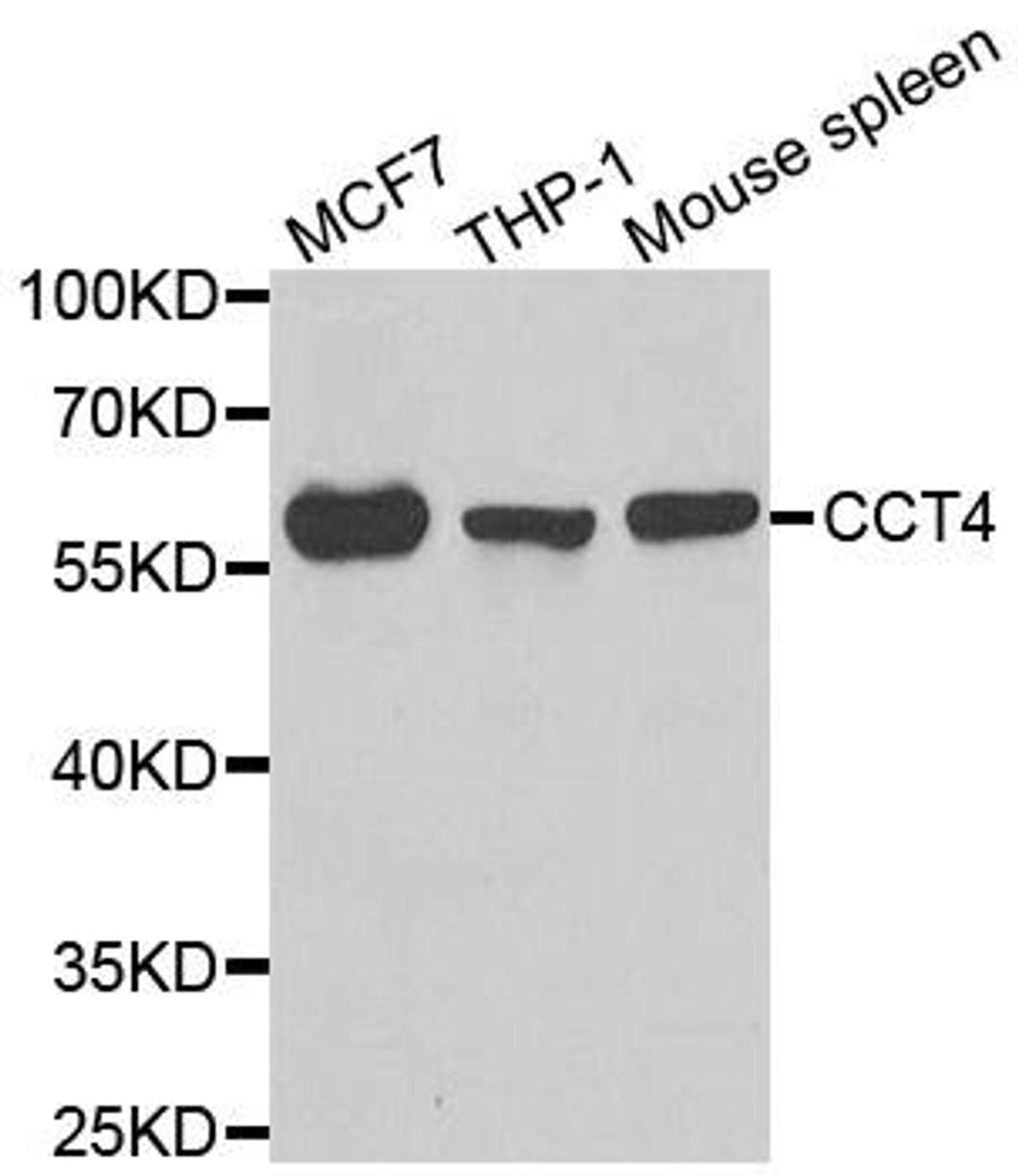 Western blot analysis of extracts of various cell lines using CCT4 antibody