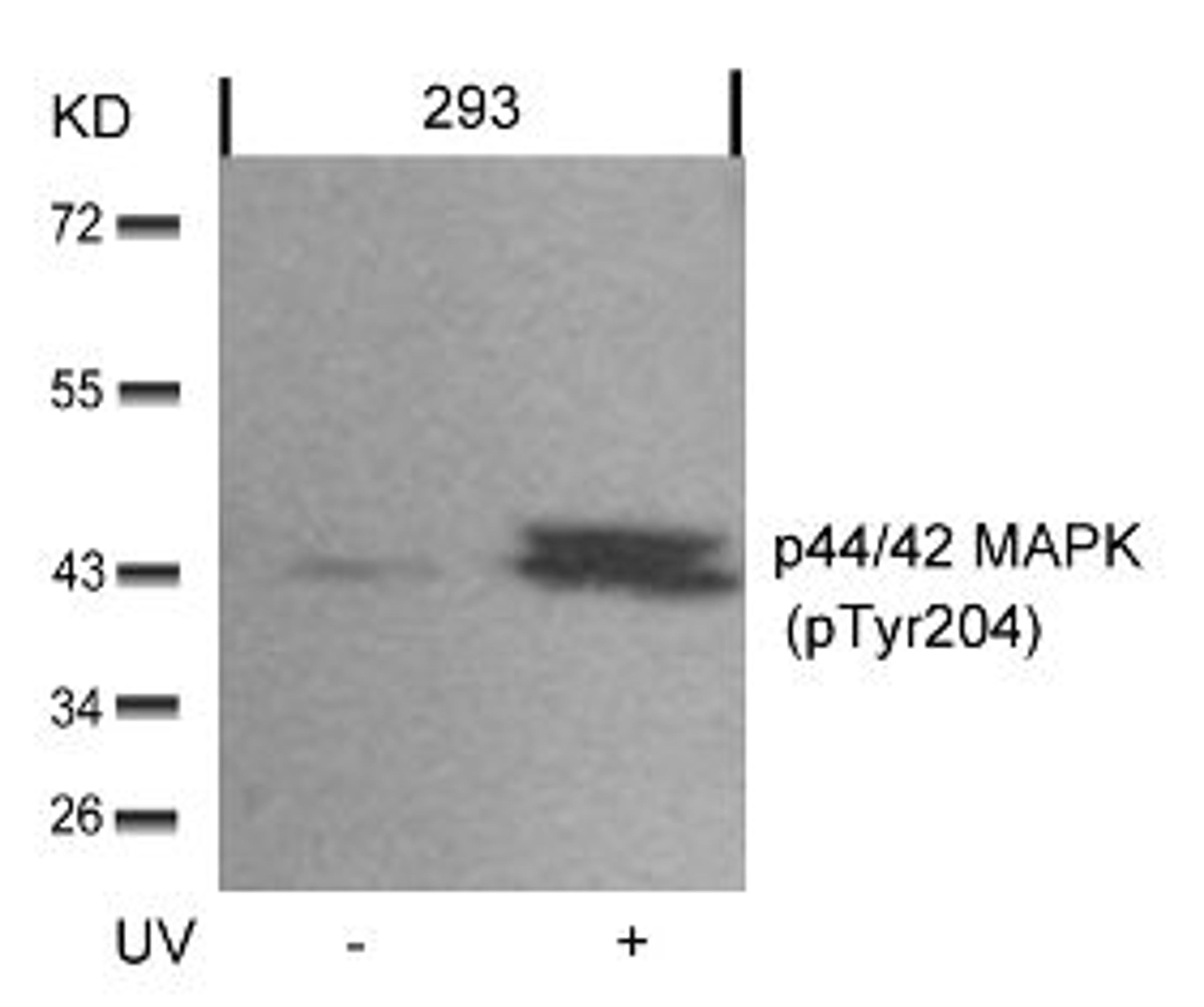 Western blot analysis of lysed extracts from 293 cells untreated or treated with UV using p44/42 MAP Kinase (Phospho-Tyr204).