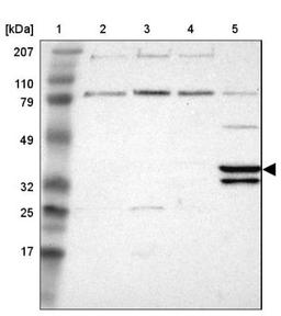 Western Blot: Pleckstrin-2 Antibody [NBP1-86180] - Lane 1: Marker [kDa] 207, 110, 79, 49, 32, 25, 17<br/>Lane 2: Human cell line RT-4<br/>Lane 3: Human cell line EFO-21<br/>Lane 4: Human cell line A-431<br/>Lane 5: Human liver tissue