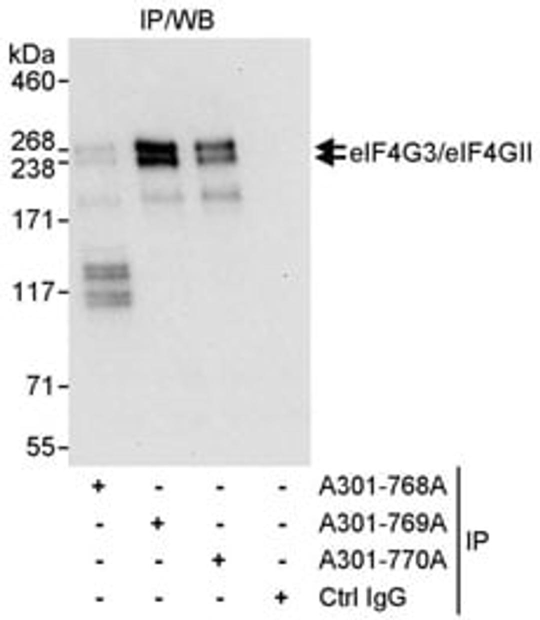 Detection of human eIF4G3/eIF4GII by western blot of immunoprecipitates.