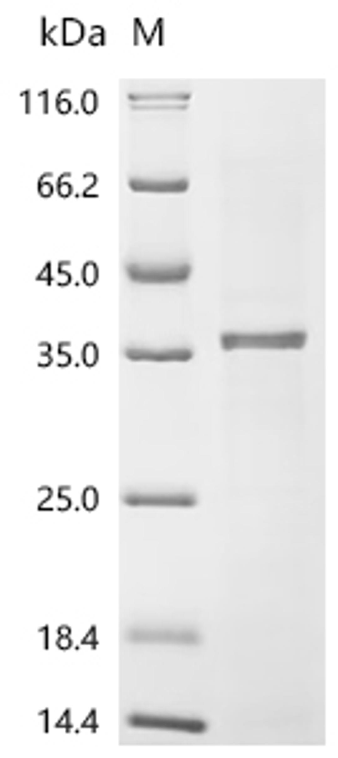 (Tris-Glycine gel) Discontinuous SDS-PAGE (reduced) with 5% enrichment gel and 15% separation gel.