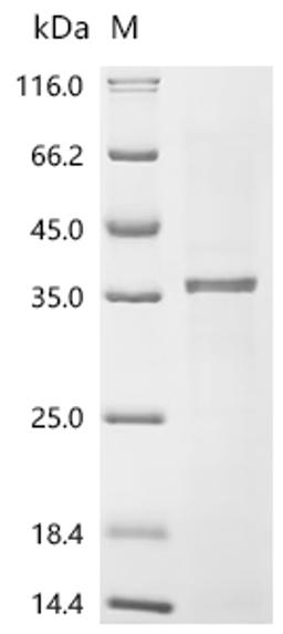 (Tris-Glycine gel) Discontinuous SDS-PAGE (reduced) with 5% enrichment gel and 15% separation gel.