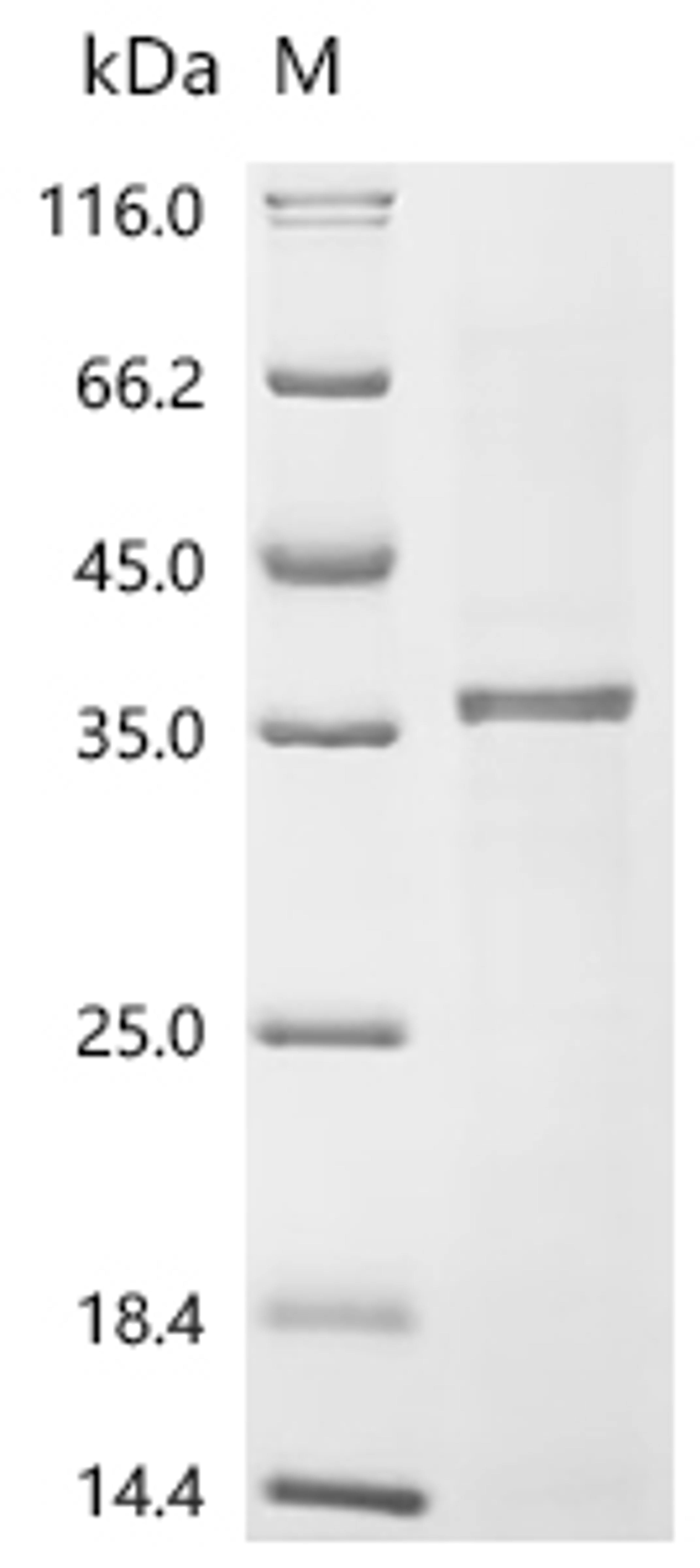 (Tris-Glycine gel) Discontinuous SDS-PAGE (reduced) with 5% enrichment gel and 15% separation gel.