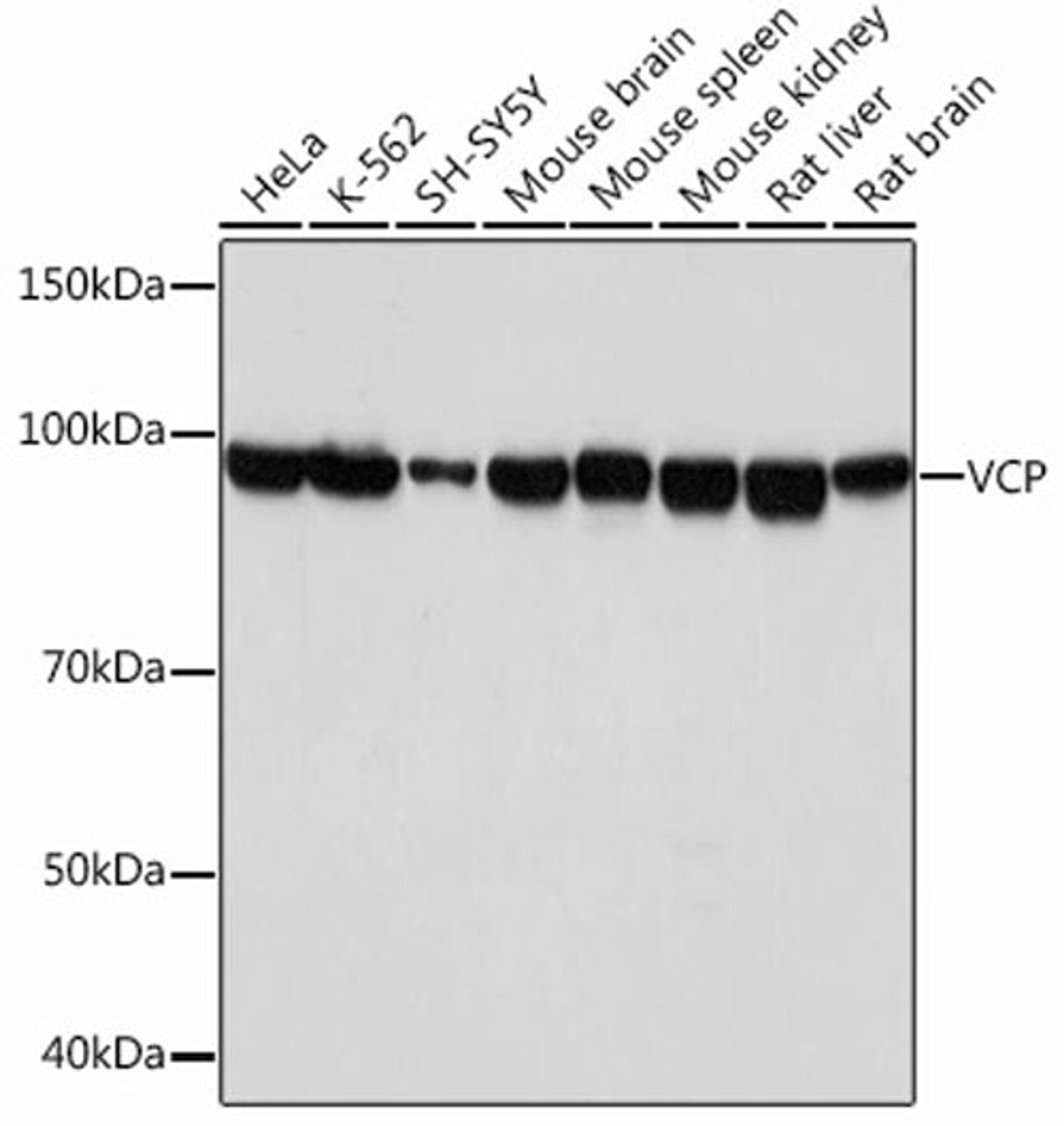 Western blot - VCP Rabbit mAb (A1402)