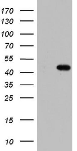 Western Blot: MURF3 Antibody (7F8) [NBP2-46224] - Analysis of HEK293T cells were transfected with the pCMV6-ENTRY control (Left lane) or pCMV6-ENTRY MURF3.