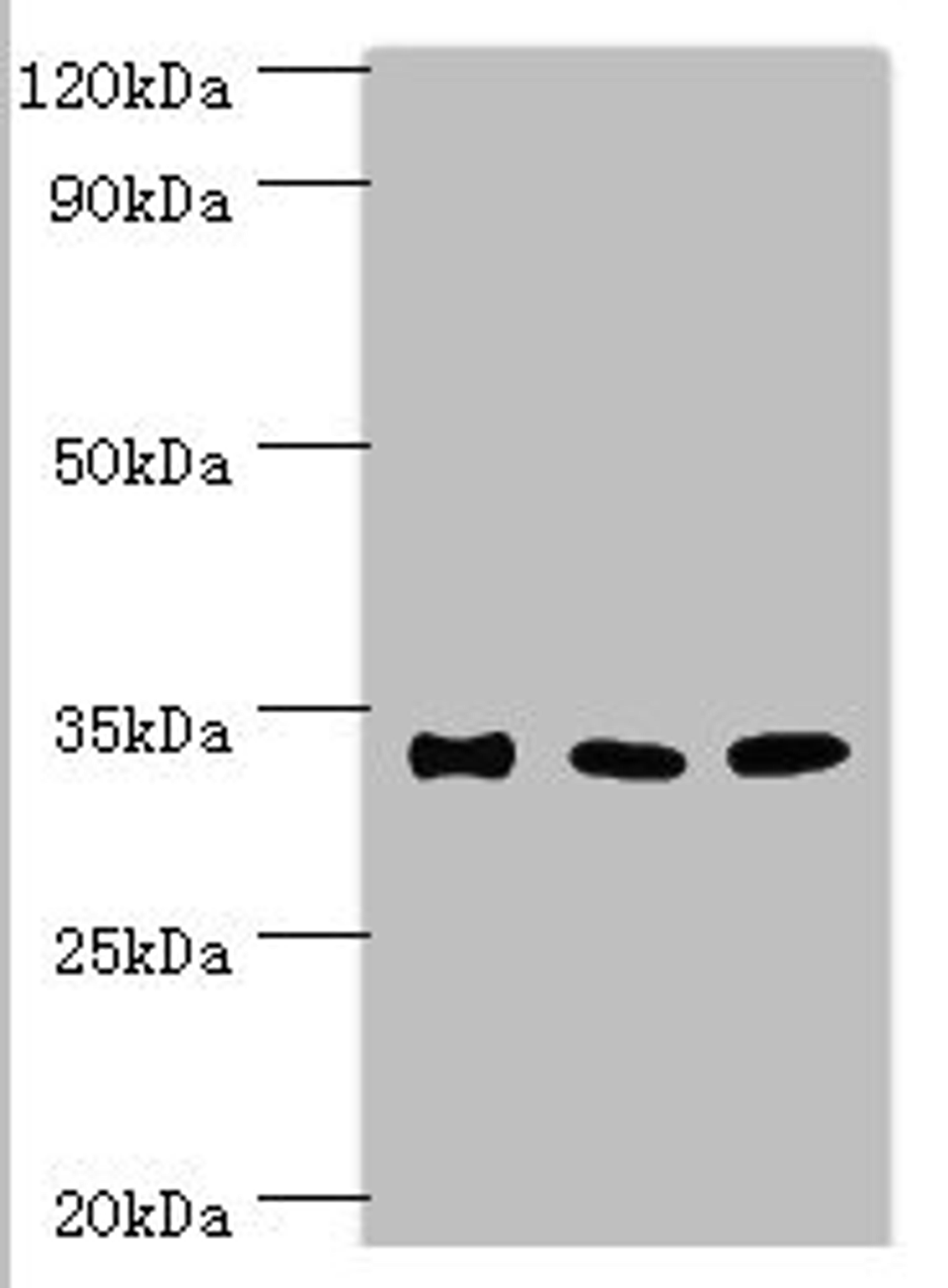 Western blot. All lanes: Sulfotransferase 1A3 antibody at 10ug/ml. Lane 1: A549 whole cell lysate. Lane 2: Mouse liver tissue. Lane 2: Mouse kidney tissue. Secondary. Goat polyclonal to rabbit IgG at 1/10000 dilution. Predicted band size: 35, 23 kDa. Observed band size: 35 kDa. 