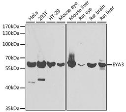 Western blot - EYA3 antibody (A7893)