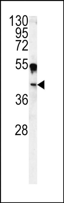 Western blot analysis of CA14 antibody in A375 cell line lysates (35ug/lane)