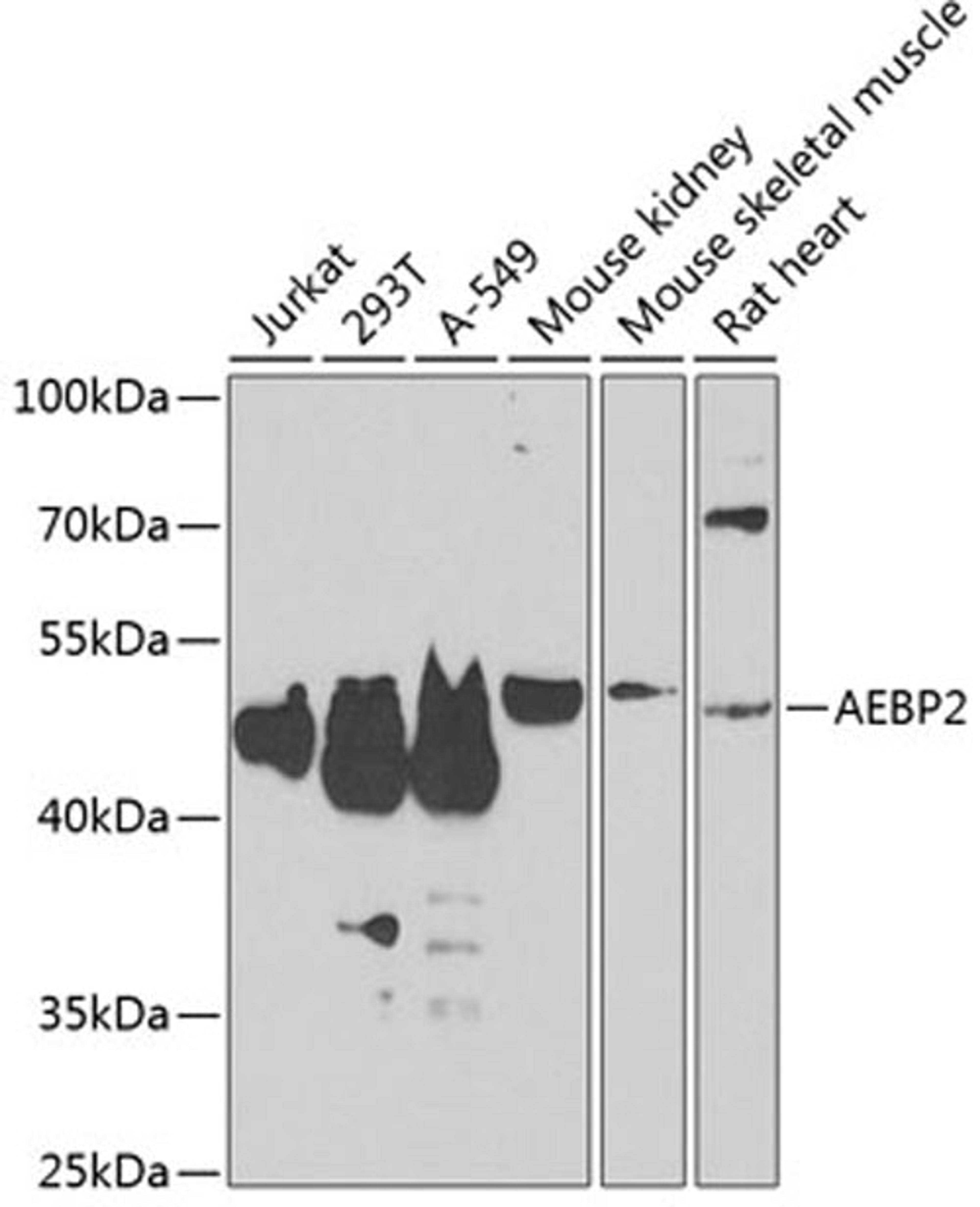 Western blot - AEBP2 antibody (A7400)