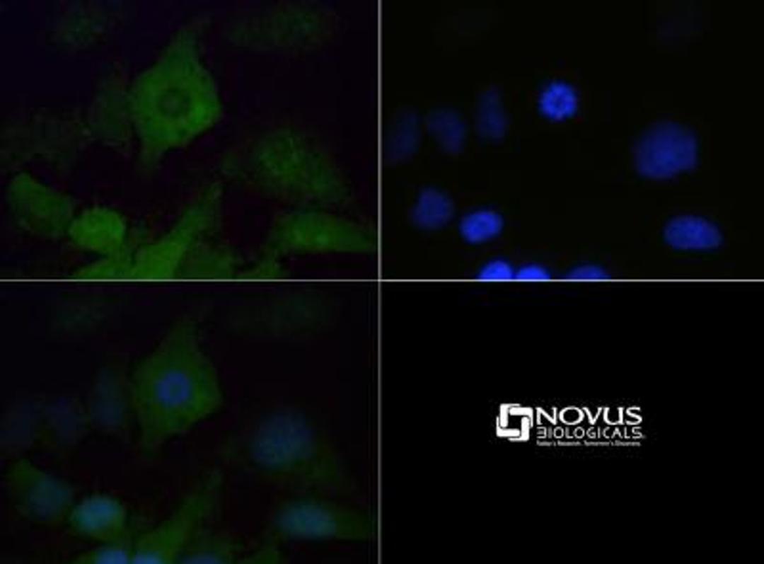 Immunocytochemistry/Immunofluorescence: VPS34 Antibody [NB110-87320] - VPS34 antibody was tested at 1:200 in HeLa cells with FITC (green). Nuclei (Blue) were counterstained with Dapi (blue).