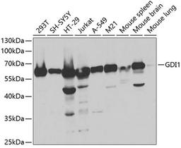 Western blot - GDI1 antibody (A5462)