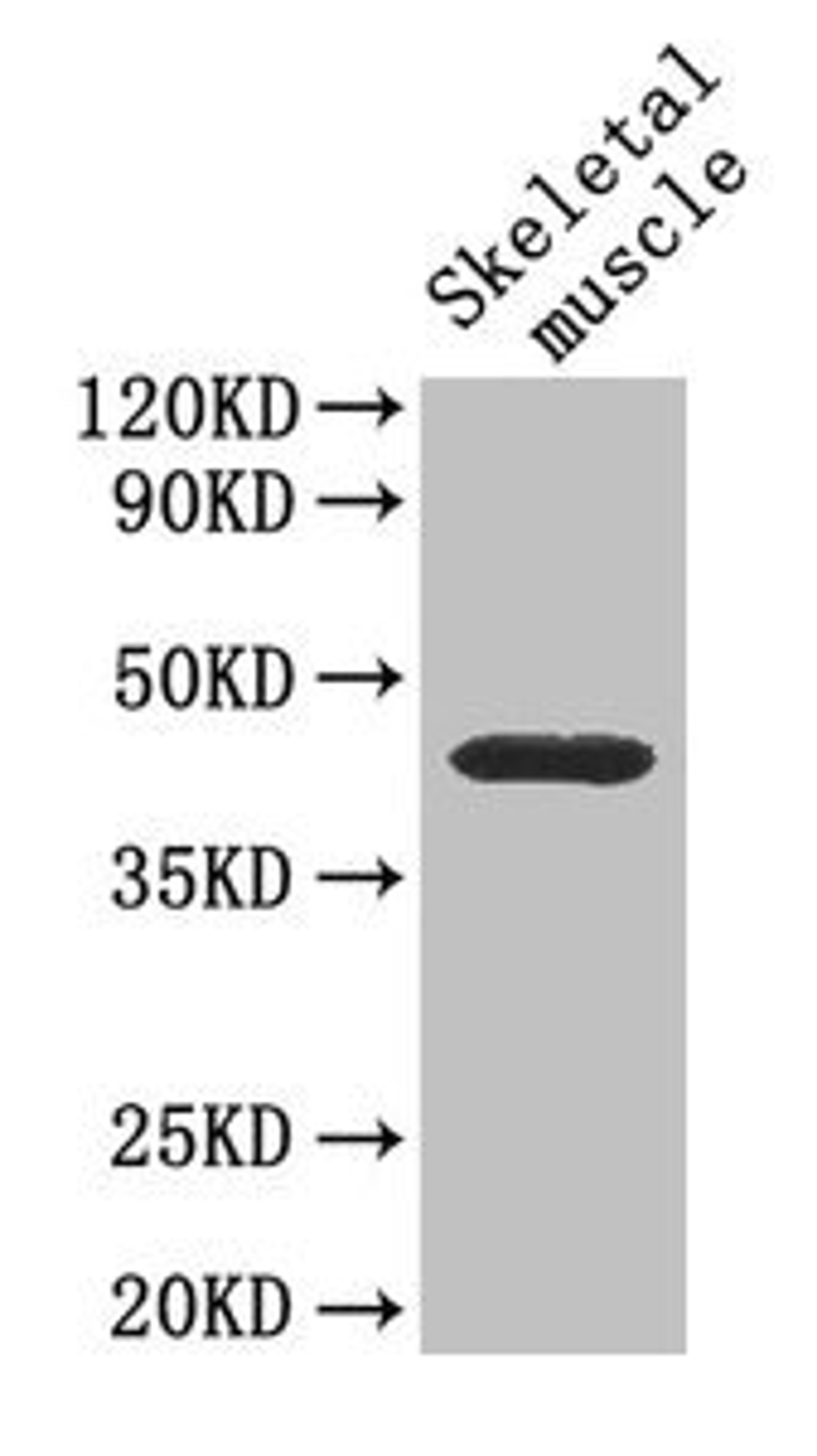 Western Blot. Positive WB detected in: Mouse skeletal muscle tissue. All lanes: Cd46 antibody at 4µg/ml. Secondary. Goat polyclonal to rabbit IgG at 1/50000 dilution. Predicted band size: 41, 34 kDa. Observed band size: 41 kDa