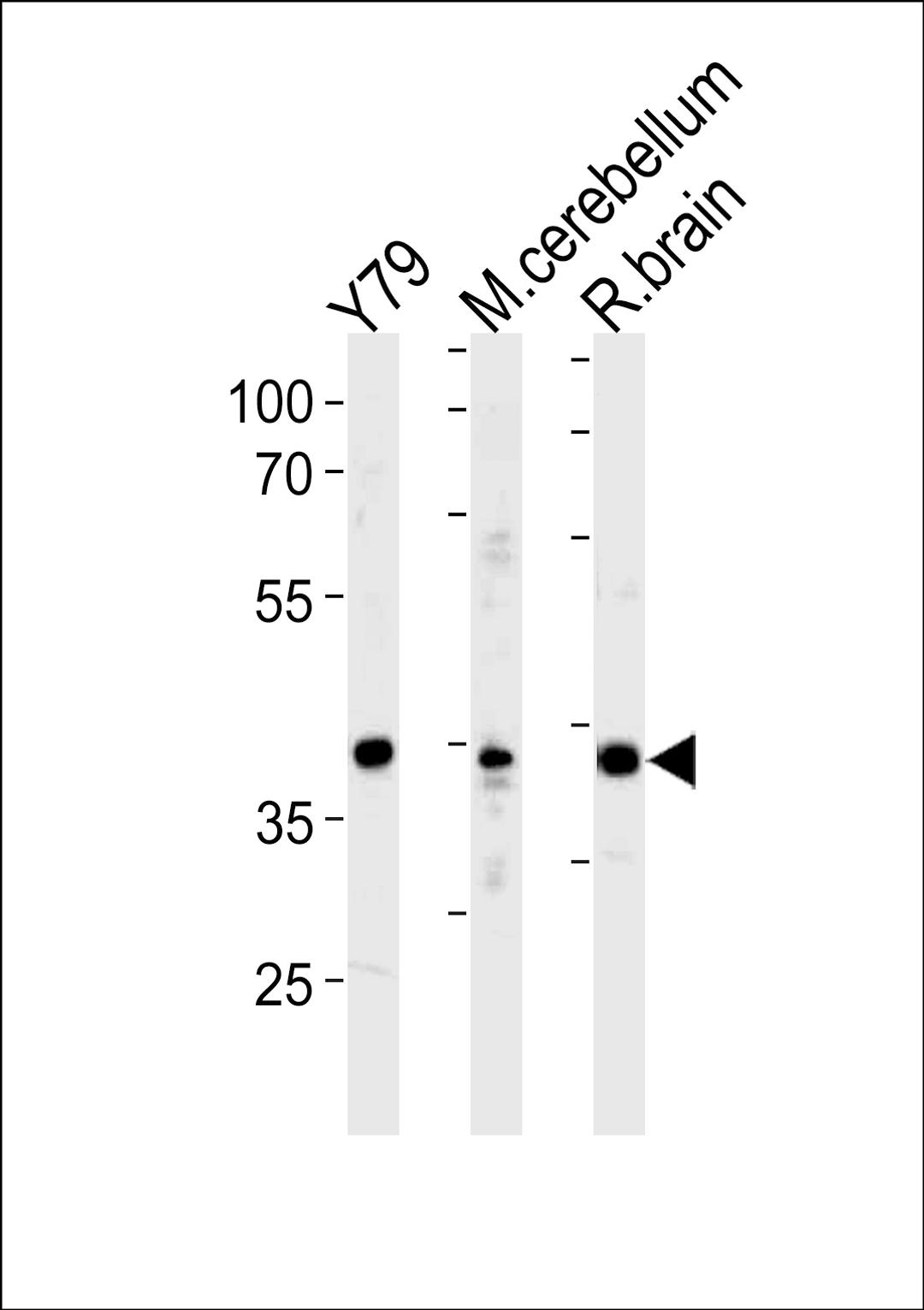 Western blot analysis in Y79 cell line ,mouse cerebellum and rat brain tissue lysates (35ug/lane).