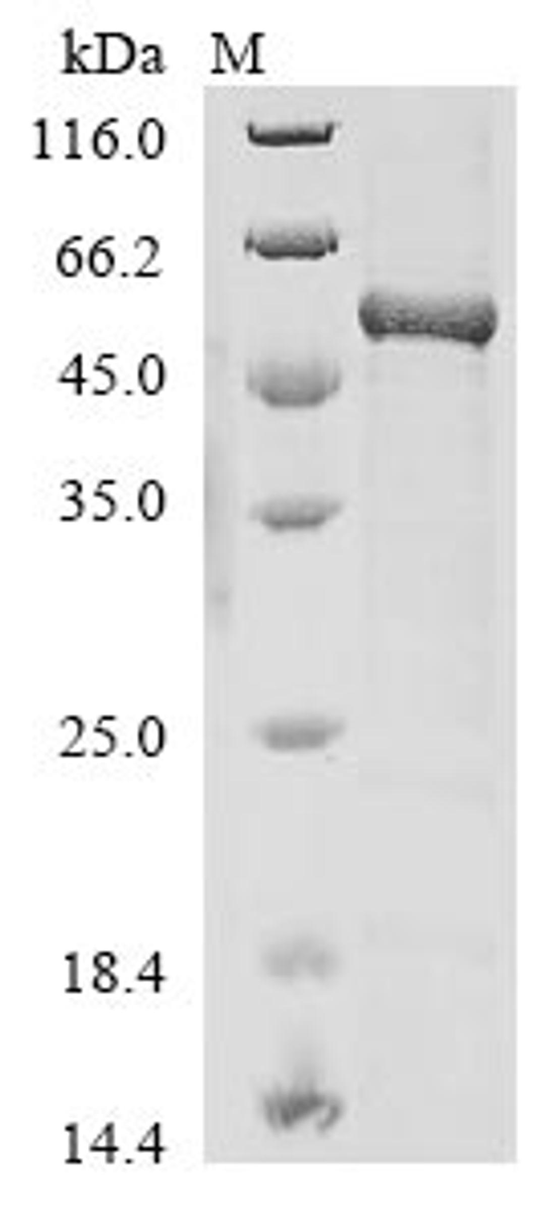 (Tris-Glycine gel) Discontinuous SDS-PAGE (reduced) with 5% enrichment gel and 15% separation gel.