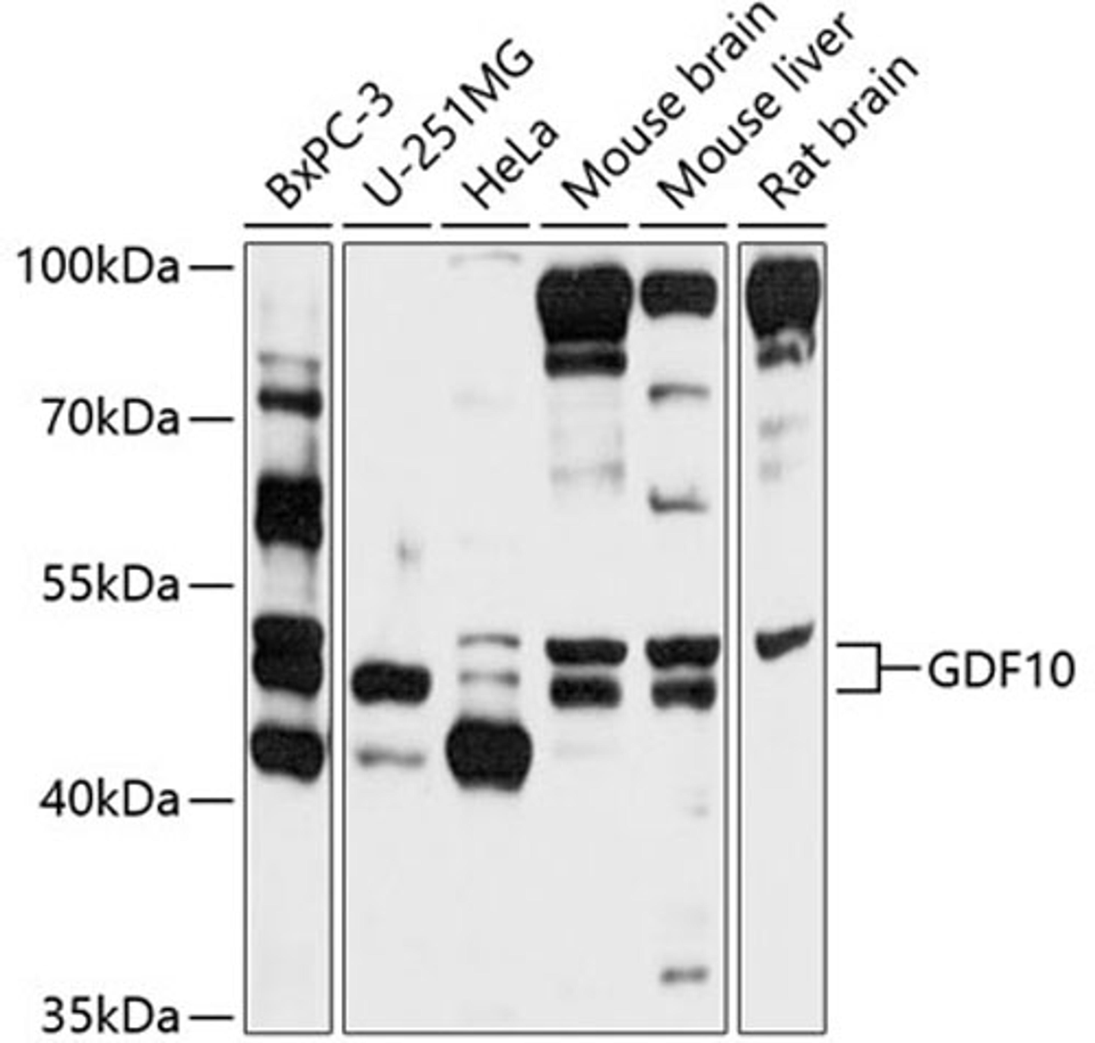 Western blot - GDF10 antibody (A10560)