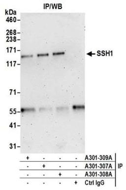 Detection of human SSH1 by western blot of immunoprecipitates.