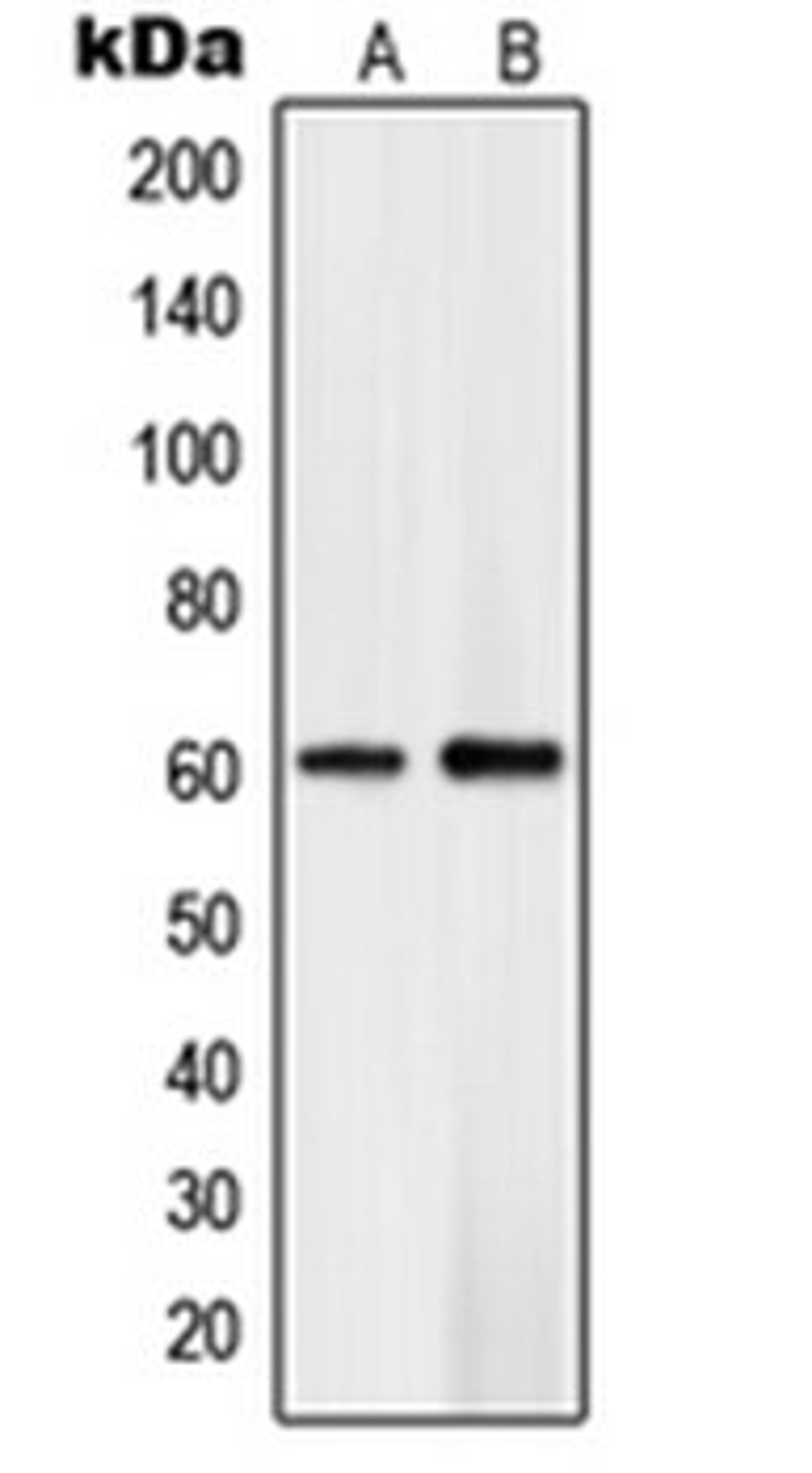 Western blot analysis of Jurkat (Lane 1), human brain (Lane 2) whole cell lysates using PLK5 antibody