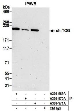 Detection of human ch-TOG by western blot of immunoprecipitates.