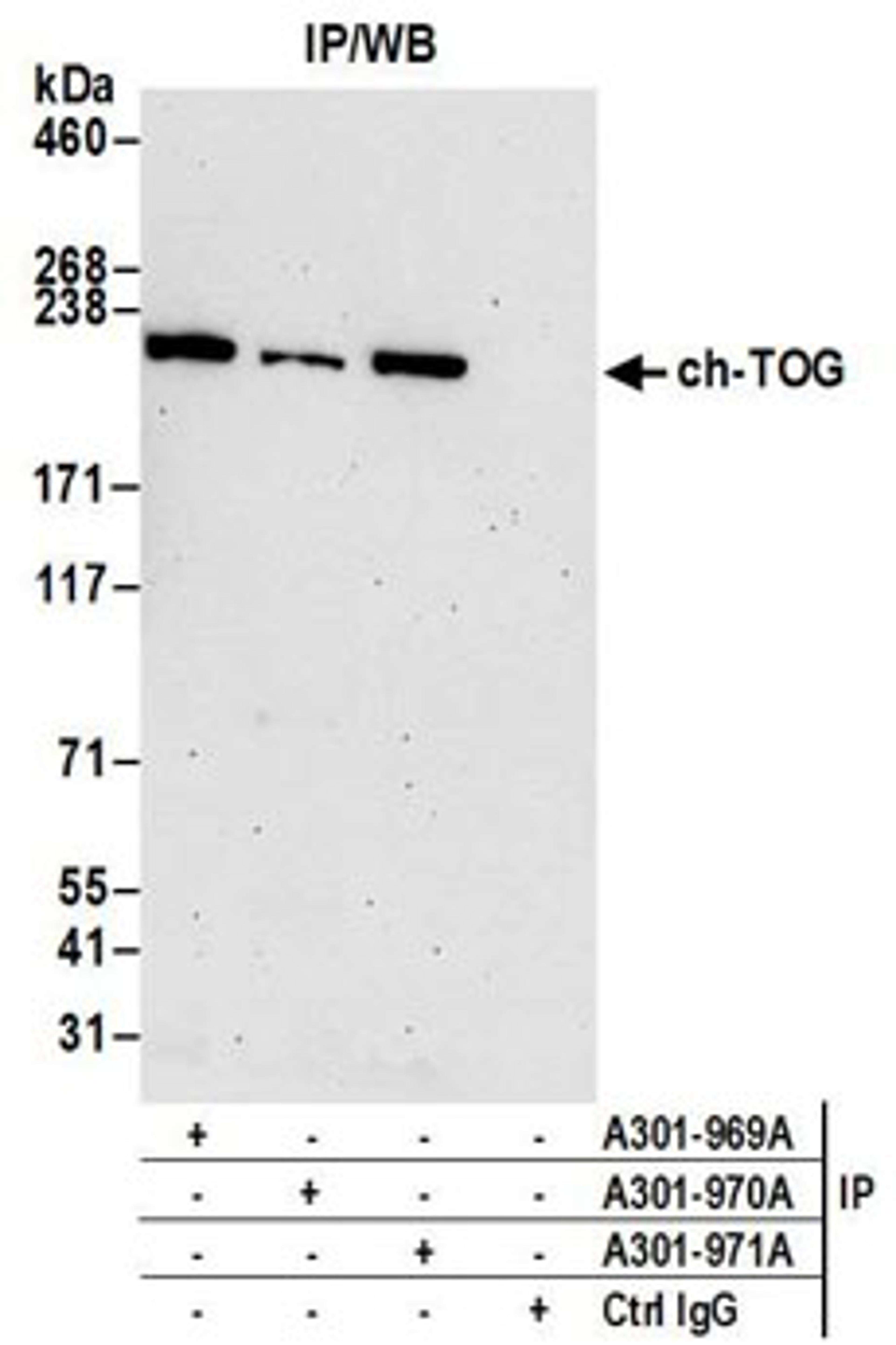 Detection of human ch-TOG by western blot of immunoprecipitates.