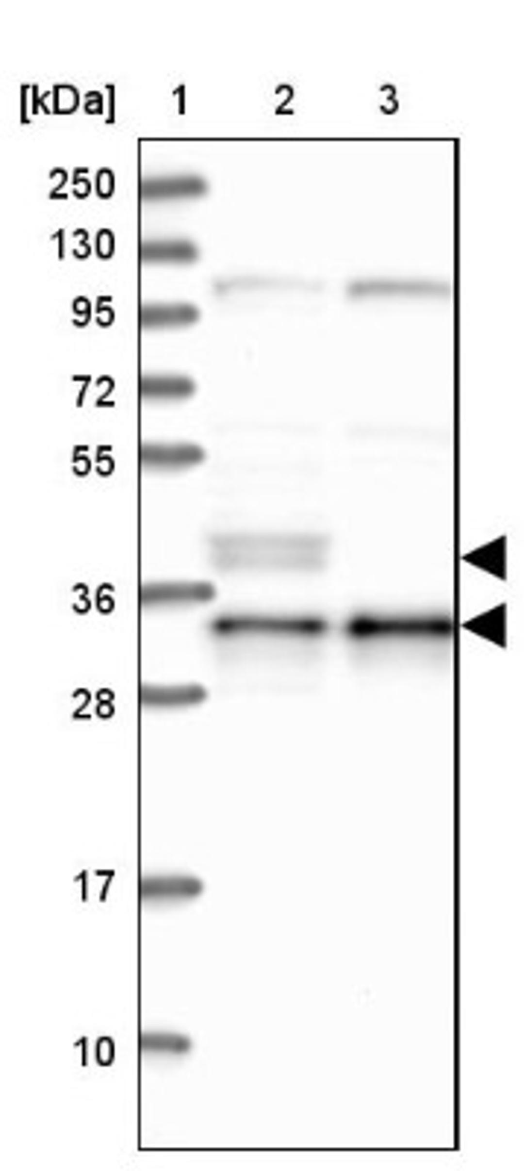 Western Blot: NDUFAF1 Antibody [NBP1-84503] - Lane 1: Marker [kDa] 250, 130, 95, 72, 55, 36, 28, 17, 10<br/>Lane 2: Human cell line RT-4<br/>Lane 3: Human cell line U-251MG sp