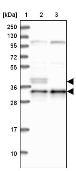 Western Blot: NDUFAF1 Antibody [NBP1-84503] - Lane 1: Marker [kDa] 250, 130, 95, 72, 55, 36, 28, 17, 10<br/>Lane 2: Human cell line RT-4<br/>Lane 3: Human cell line U-251MG sp