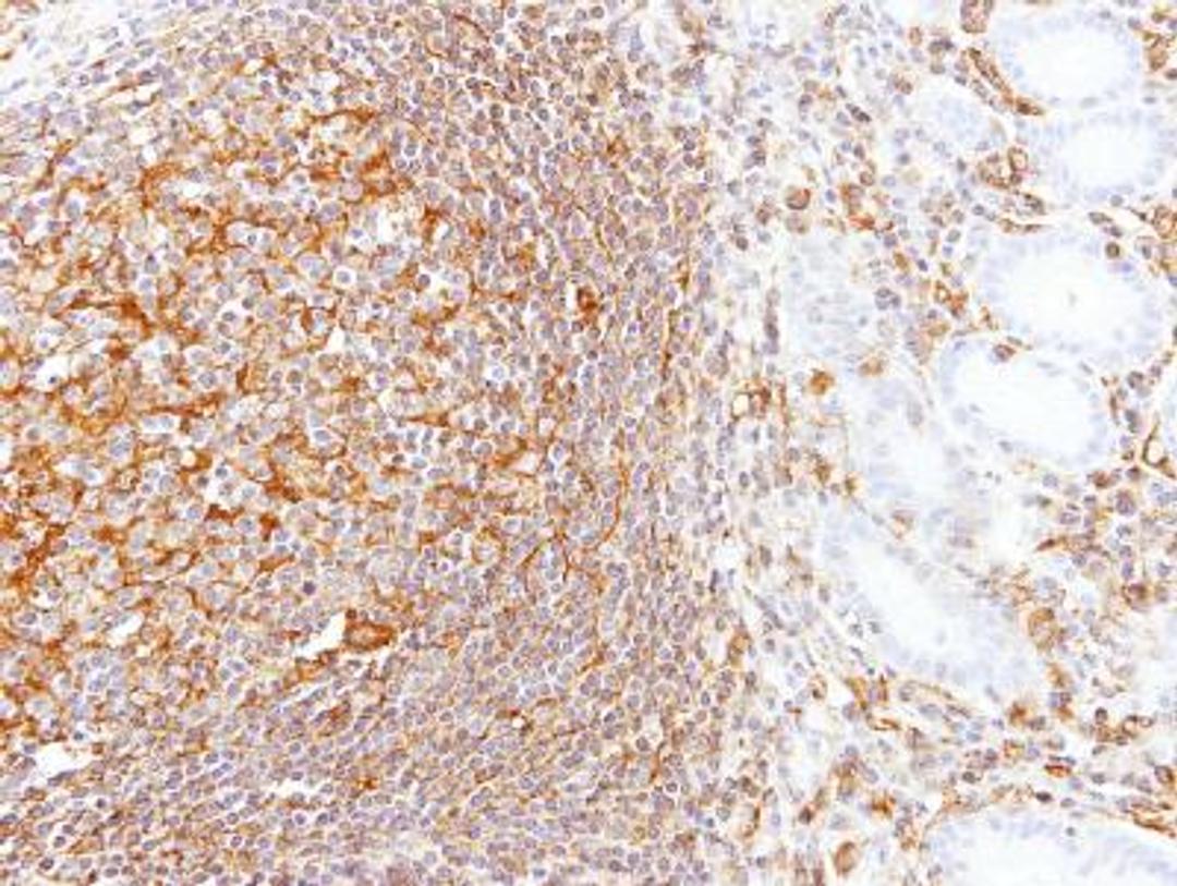 Immunohistochemistry-Paraffin: LBP Antibody [NBP1-32407] - Paraffin-embedded Gastric N+T, using antibody at 1:100 dilution.