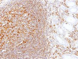 Immunohistochemistry-Paraffin: LBP Antibody [NBP1-32407] - Paraffin-embedded Gastric N+T, using antibody at 1:100 dilution.