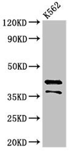 Western Blot. Positive WB detected in: K562 whole cell lysate. All lanes: PAX5 antibody at 3.2µg/ml. Secondary. Goat polyclonal to rabbit IgG at 1/50000 dilution. Predicted band size: 43, 39, 36, 33, 32, 38, 35 kDa. Observed band size: 43, 36 kDa