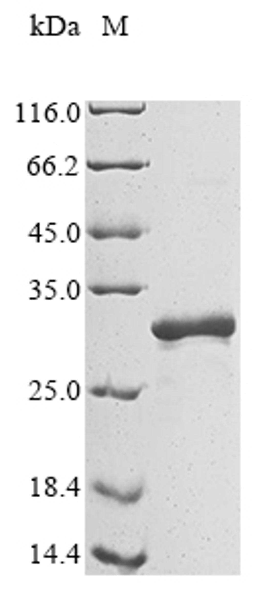 (Tris-Glycine gel) Discontinuous SDS-PAGE (reduced) with 5% enrichment gel and 15% separation gel.
