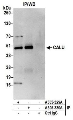 Detection of human CALU by western blot of immunoprecipitates.