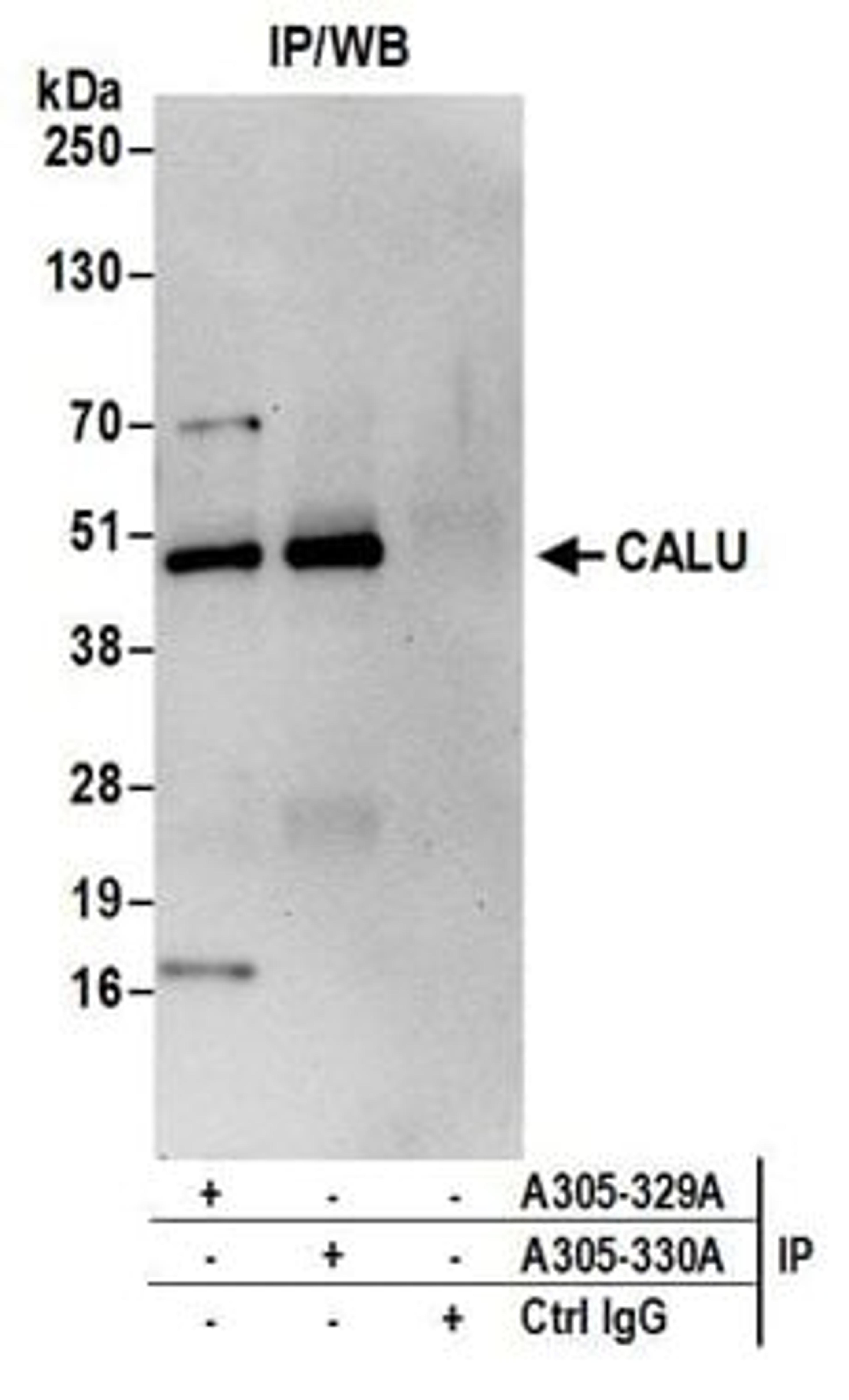 Detection of human CALU by western blot of immunoprecipitates.